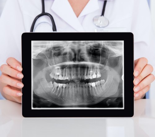 Panoramic dental x-rays on tablet computer