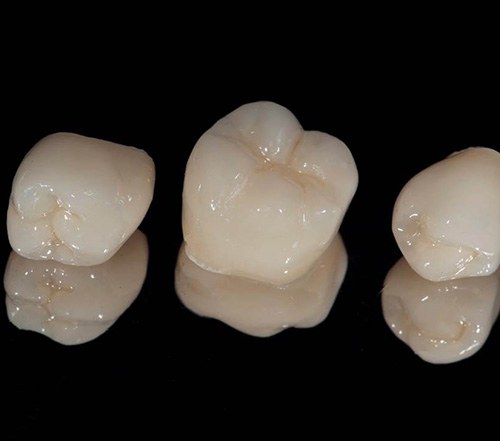 Close-up of three CEREC dental crowns in Cocoa Beach, FL
