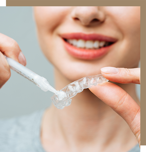 Woman using an at-home teeth whitening kit