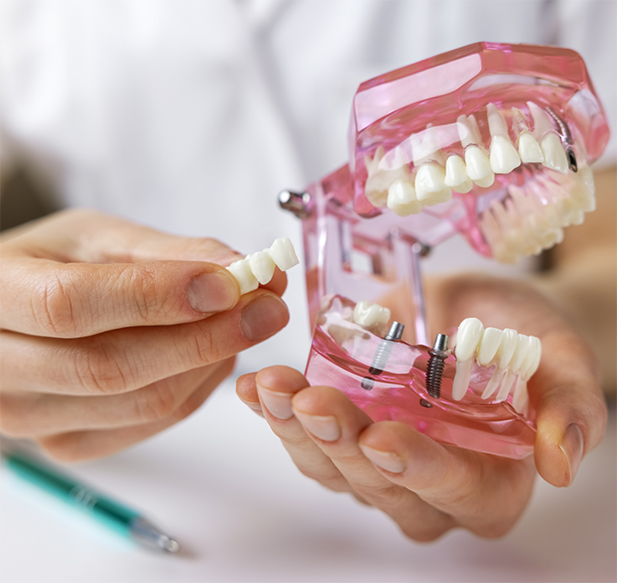 Dentist holding a dental bridge and a model of the teeth