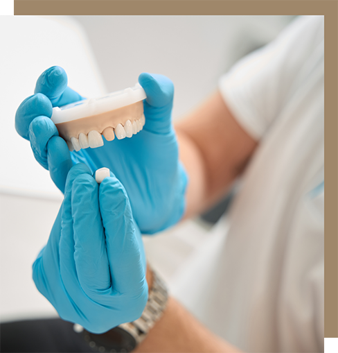 Dentist placing a dental crown over a model of a tooth