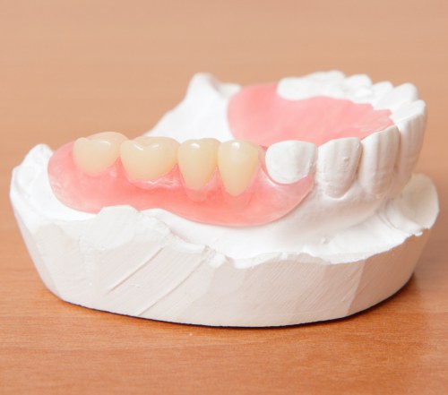 Model smile with partial denture