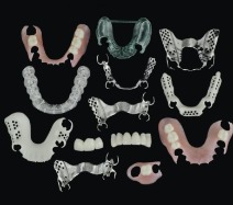 Numerous types of partial denture