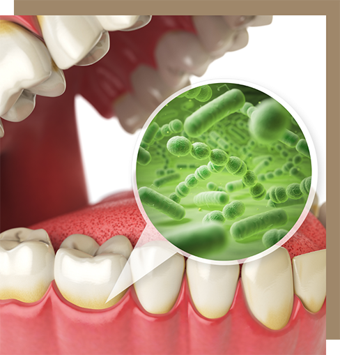 Illustration of gums with pathogens