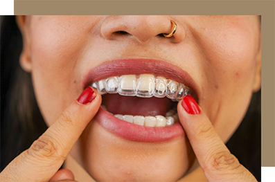Woman pointing to the clear aligner on her upper teeth