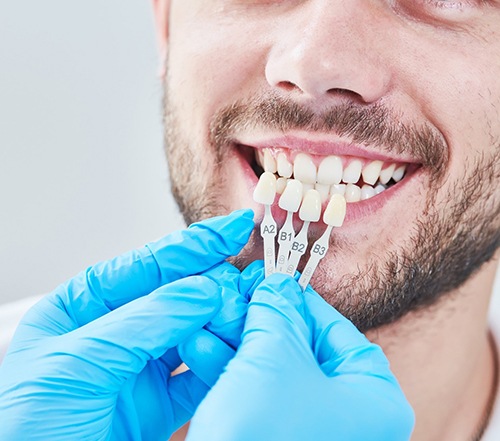 Dentist holding shade guide next to teeth