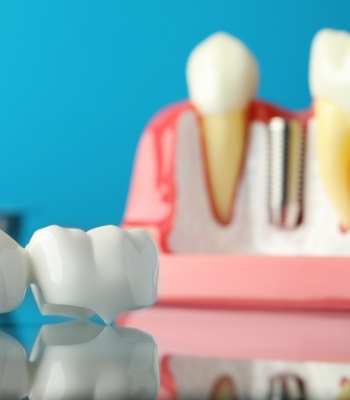 Man with white hair looking into mirror as dentists points to his teeth