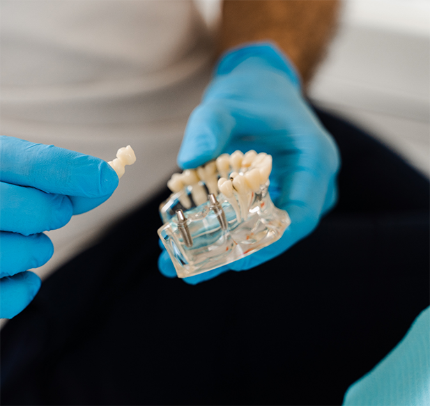 Dentist holding a dental bridge and a model of the teeth