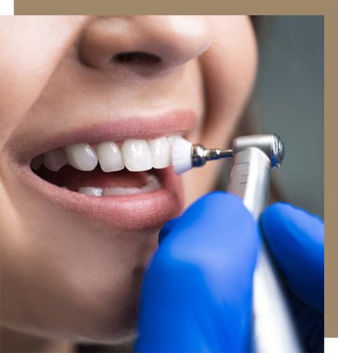 Dental patient having fluoride applied to their teeth