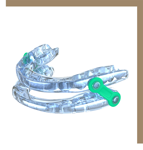 Oral appliance tray