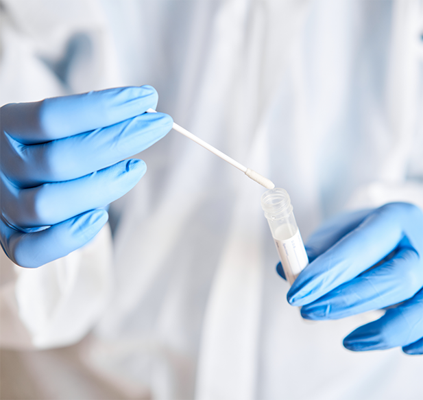 Dentist placing a cotton swab in a vial