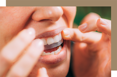 Putting a whitening strip on the teeth