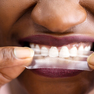 closeup of patient using teeth whitening strip