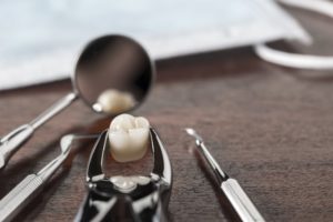 tooth extraction