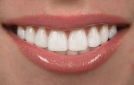 Close-up of a beautiful smile