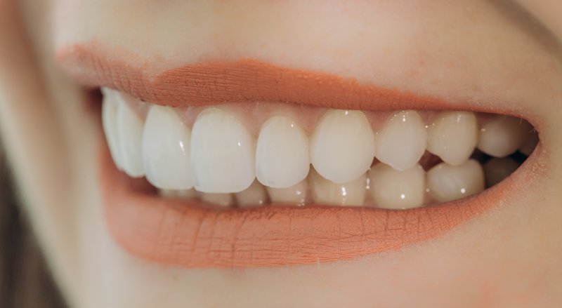 Woman smiling with veneers