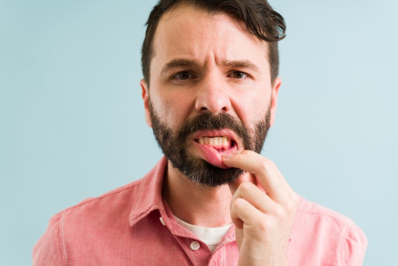 A young man suffering gum disease