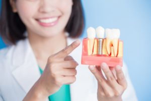 a person holding a model of dental implants 