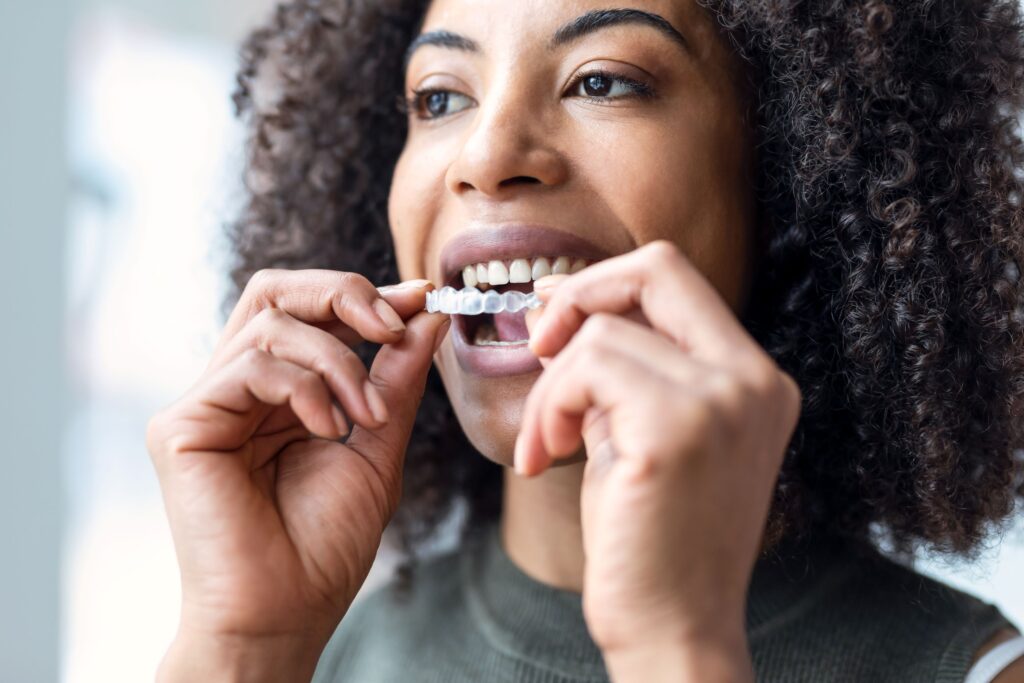 Woman inserting Invisalign over upper arch of teeth